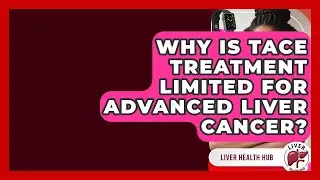 Why Is TACE Treatment Limited For Advanced Liver Cancer? - Liver Health Hub