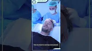Hair transplantation with DHI Method - Estpital Clinic