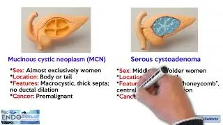 PANCREATIC CYSTS: “They are not always what they seem”