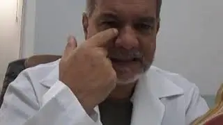 Rinoplastia - Dorso nasal. O que podemos modificar no dorso nasal? Estreitar? Rebaixar? Elevar? #42