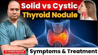 Solid vs Cystic Thyroid Nodule - Which Is Dangerous? |  Treatment Without Surgery