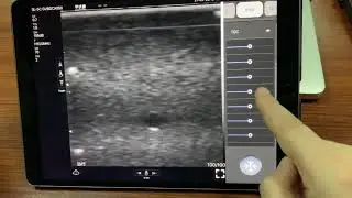 microVue