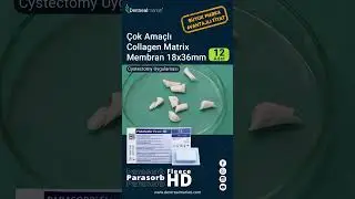 Dentrealmarket - &Ccedil;ok ama&ccedil;lı Collagen Matrix Membran ile Cystectomy Uygulaması