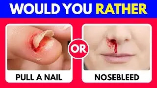 Would You Rather&hellip;? 60 HARDEST Choices Ever! 🔥😱🧠 EXTREME Edition | Nexo Quiz