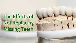 The Effects of Not Replacing Missing Teeth