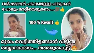 🔥വർഷങ്ങൾ പഴക്കമുള്ള പാടുകളെല്ലാം മാറ്റി മുഖം വെട്ടിത്തിളങ്ങാൻ ✨ അത്ഭുതകൂട്ട് 💯👍|#anussimplybeauty