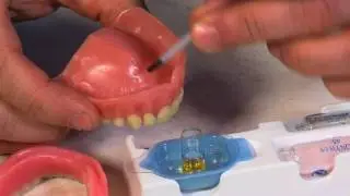 Dentureliner, Denture Relining Cushion Stabilizer