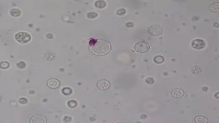 Phase inversion of multiple emulsion (Rhodamine B) #2