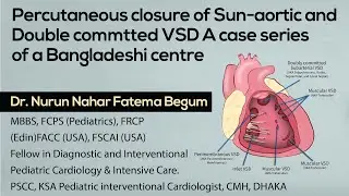 Percutaneous closure of Sun-aortic and Double commtted VSD A case series of a Bangladeshi centre
