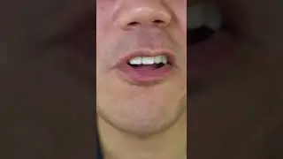 ASMR | Toxic Waste Hazardously Sour Candy | Grape-Strawberry #DoctorTristanPeh #ASMR #Shorts