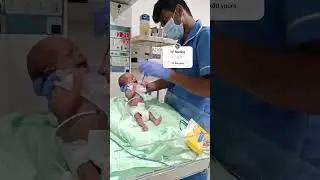 CF FEEDING #baby #babyearpiercing #cutebaby #earpiercing #babygirl #cute #earpiercingideas #love