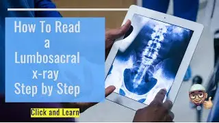 🤯 How to Read a Lumbar spine x ray, Lumbar Spine, Lower Back Pain.