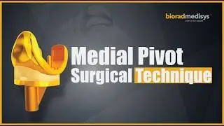 Surgical Technique: Medial Pivot Knee (MPK) Replacement (Excel MPK/ OURO Excel MPK)