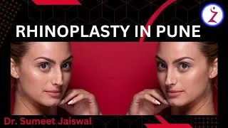 Rhinoplasty In Pune | Septoplasty Rhinoplasty Surgery In Pune | Zenith Clinic