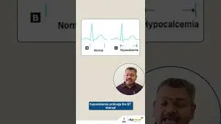 ECG Changes that Happen Due to Electrolyte Disturbances | Dr Archith Boloor