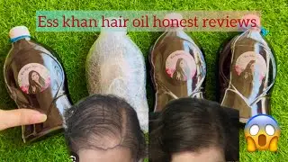 Ess khan hair oil | honest reviews | yes or no?? 🤔