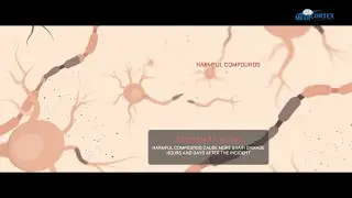How repeated concussions affect your brain
