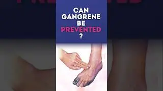 Tips to prevent gangrene | Dr Kaurabhi Zade