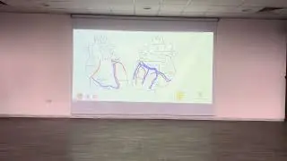Lec.45 | Ишемическая болезнь сердца | Доктор Амджад