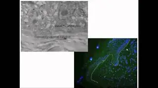 Video 4 The dermal - epidermal junction