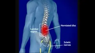 back pain relief charlotte