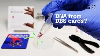 How to prepare Dried blood spot cards for DNA isolation?