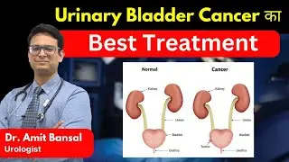 Urinary Bladder Cancer का सही इलाज : क्या आपको Robotic Surgery चुननी चाहिए? I Dr. Amit Bansal