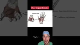 Extreme muscle spasm! #MuscleSpasm #Cramp #Hand #Potassium #Educational #Medical #Nurse #Doctor