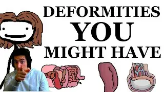 Deformities That You Might Have By Sam O'Nella Academy Reaction