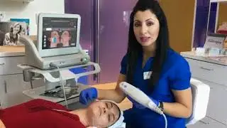 Ultherapy Full Face Treatment Demonstration
