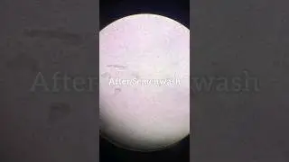 Semen Wash For IUI || Sperm Wash || Intrauterine Insemination #iui #semenwash #semen