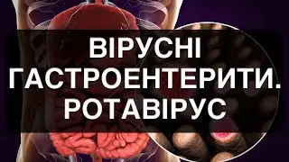 Вірусні гастроентерити (рота-, норо-, сапо-, астровіруси)