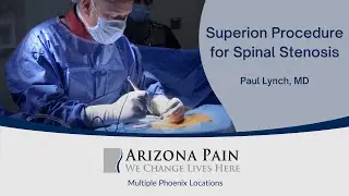 Watch A Superion Procedure For Spinal Stenosis | Arizona Pain