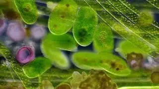 xQc- Bacteria Music