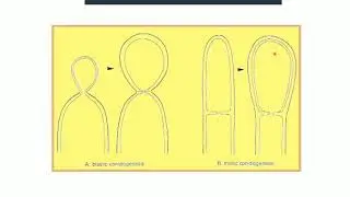 MICOLOGÍA sesión teórica 4: Reproducción de los hongos. Asexual: Gemación, esporangiosporas