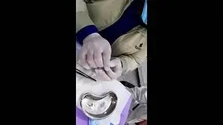 ENDO 101
