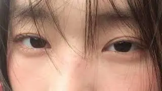 Low fatty eyelid crease subliminal