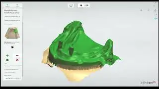 Barre conjonction CAO 3Shape