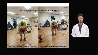 Hamstring injuriy? A must watch for long lasting relief. Phoenix Waveform