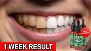 Dentitox Pro Dental Supplement Review - Dentitox Pro Drops Review - Dentitox Pro Review