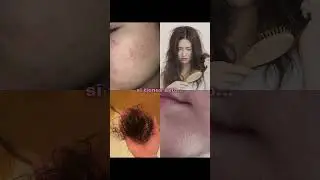 LOS SECRETOS para ACN&Eacute;, PIEL SECA, CA&Iacute;DA de CABELLO y PELO DA&Ntilde;ADO que NADIE TE CUENTA #skincare