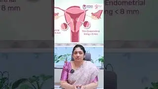 When Is Intrauterine Device Insertion Recommended? || Ankura Hospital #shorts #healthfacts #iud