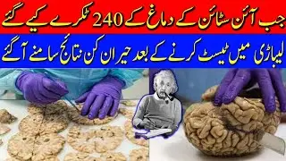 Albert Einstein's Brain | Research after death | Tragic Story
