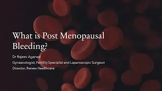 Post Menopausal Bleeding or Bleeding After Menopause - What is it and how should you deal with it?