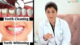 What is the difference between Teeth Cleaning and Whitening? Our expert dentist Dr. Namrata explains