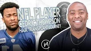 Former NFL Player Cedric Thompson&rsquo;s Full Hair Transplant Journey 🏈 4100 Grafts at Heva Clinic