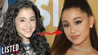 9 Best Celebrity Glow-Ups