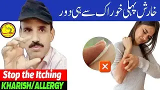 Stop Itchy,Red Bumpy Skin | Kharish Ka Khatma, Eczema! (Urdu/Hindi) Herbal World 
