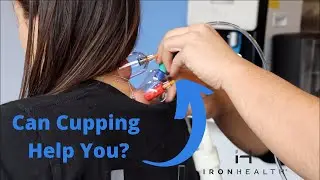 Can you cup neck pain?