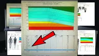 Angry Quad Dexa scan talk 2